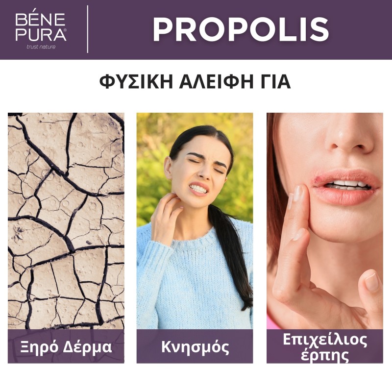 Αλοιφή για κνησμό με 30% Πρόπολη - 40 ml