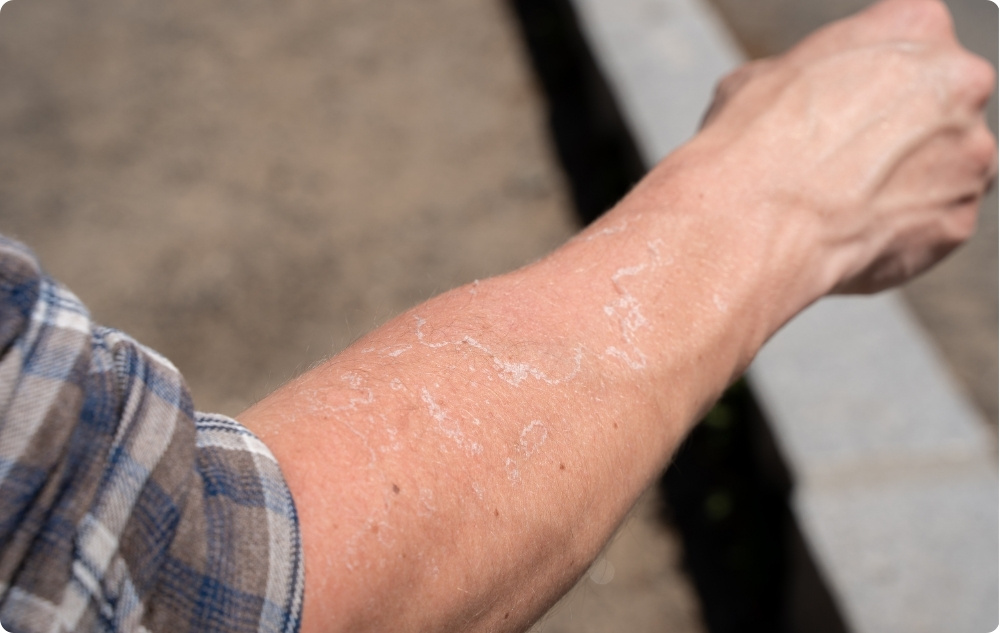 Ως λάδι για ερεθισμένο και ξηρό δέρμα